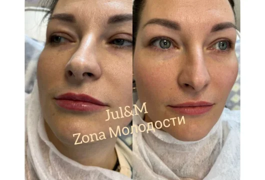 студия косметологии zona молодости фото 5 - nailrus.ru
