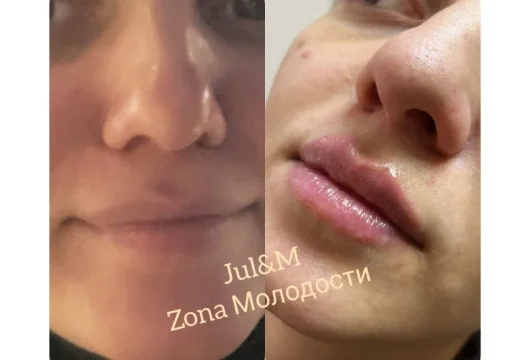 студия косметологии zona молодости фото 18 - nailrus.ru