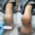 студия подологии и остеопатии вера фото 2 - nailrus.ru